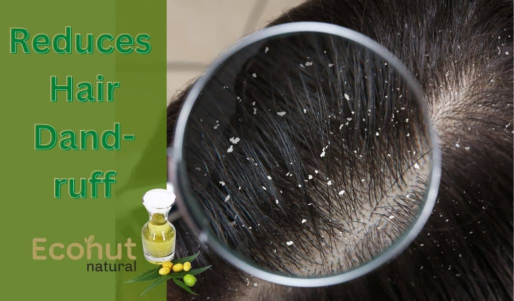 neem oil reduces hair dandruff