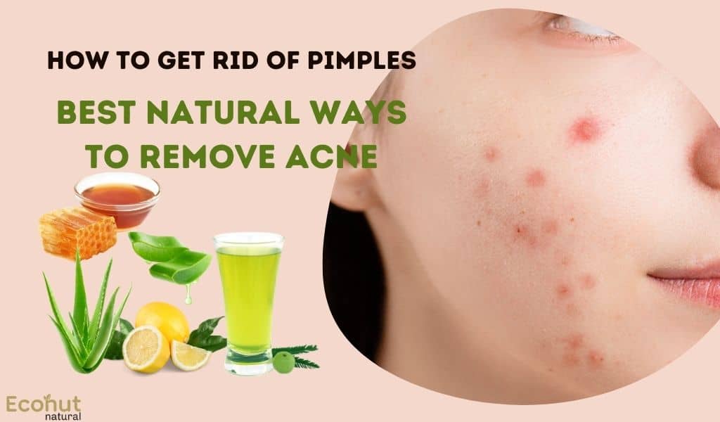 Ways to Remove Acne
